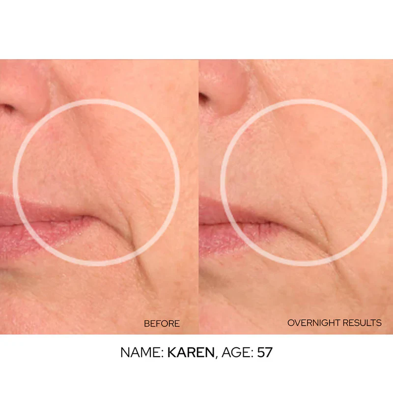 SiO Super LipLift - Image 8