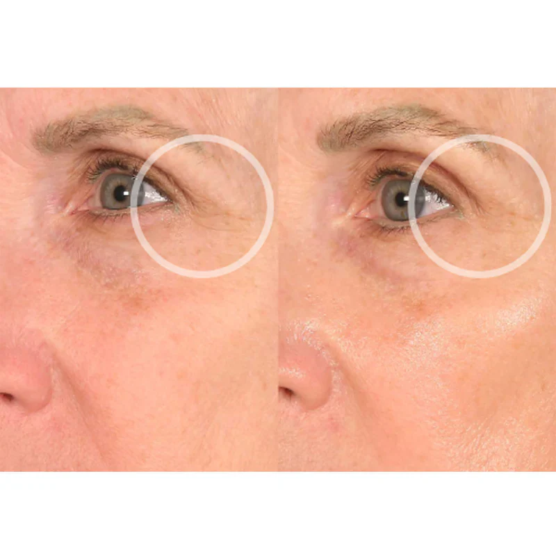 SiO SuperLift Pack - Image 10