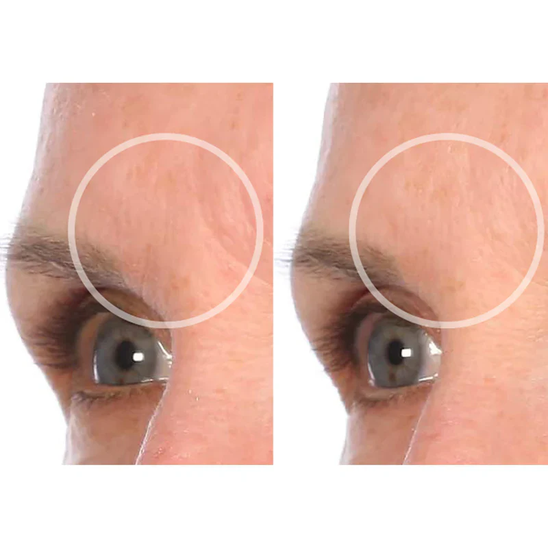 SiO SuperLift Pack - Image 9