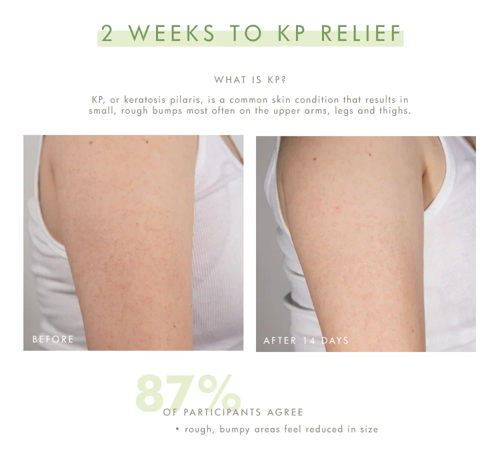 Smooth Reveal: Resurfacing Silky Serum - Image 4